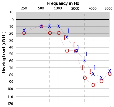 audiogram-chart.jpg