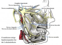 Lokalanaesthesie-Injektionspunkte_Trigem_+_+_+__.jpg